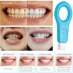 Pro Nano Teeth Whitening Kit