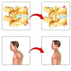 Adjustable Back Stretcher