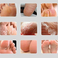 Exfoliating Feet Mask (3 Bags = 6pcs)